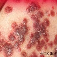 여중생 에이즈 감염, 누구의 잘못인가