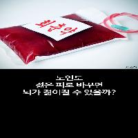 노인도 젊은 피로 바꾸면 뇌가 젊어질 수 있을까?