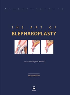 THE ART OF BLEPHAROPLASTY | InChang Cho - 교보문고
