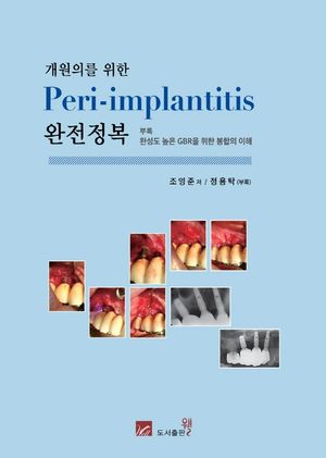 [국내도서] Peri-implantitis 완전정복