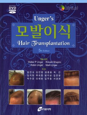 [국내도서] 모발이식