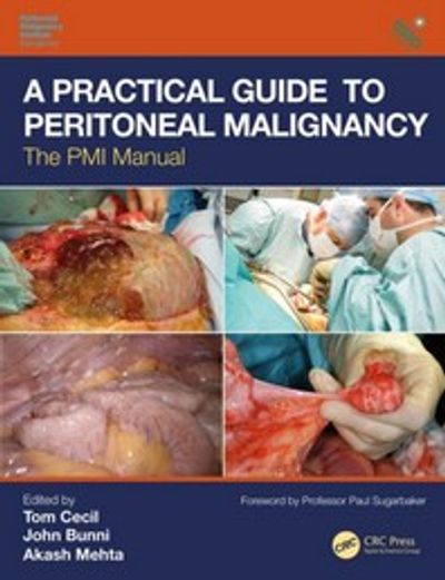 A Practical Guide to Peritoneal Malignancy | Cecil, Tom A Practical Guide to Peritoneal Malignancy | Cecil, Tom