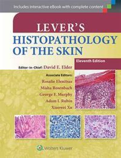 Lever's Histopathology of the Skin - 교보문고