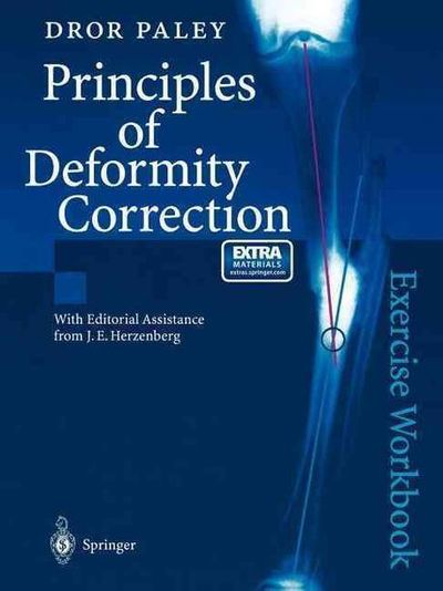 語学・辞書・学習参考書 principles of deformity correction 61x+Pz3L4BL._UF350,350_QL50_.jpg