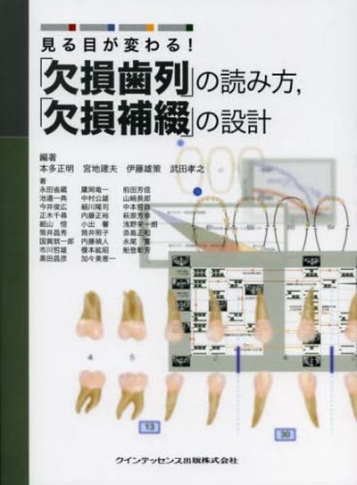 見る目が變わる!「欠損齒列」の讀み方,「欠損補綴」の設計 | 本多正明
