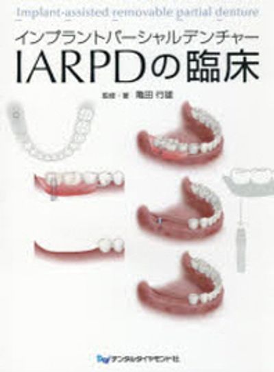 【裁断済み】パーシャルデンチャーの基本を押さえた10D・ARPDの臨床 インプラントパ-シャルデンチャ-IARPDの臨床 - 교보문고