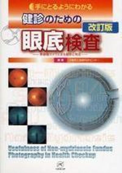 手にとるようにわかる健診のための眼底檢査 無散瞳カメラによる撮影と