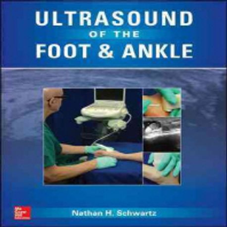 Ultrasound of the Foot and Ankle | Nathan Schwartz - 교보문고