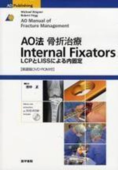 AO法骨折治療Internal Fixators LCPとLISSによる内固定/MichaelWagner