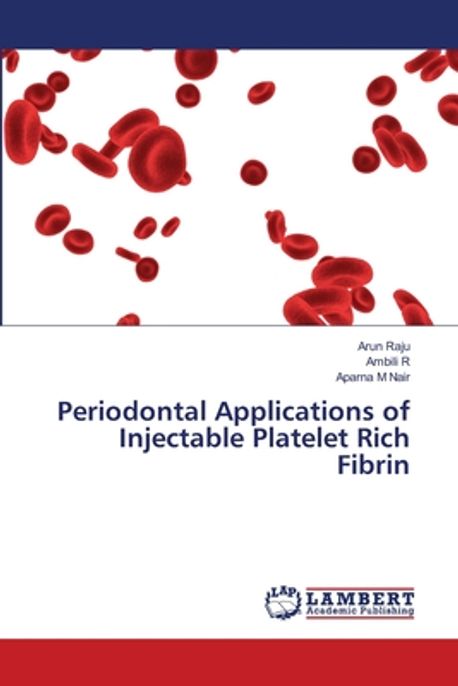 Periodontal Applications of Injectable Platelet Rich Fibrin | Raju ...
