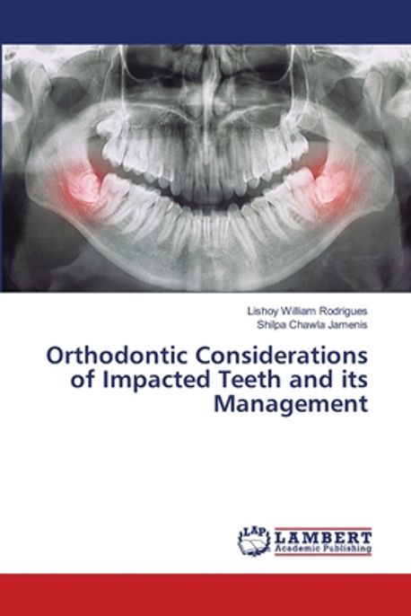 Orthodontic Considerations of Impacted Teeth and its Management ...