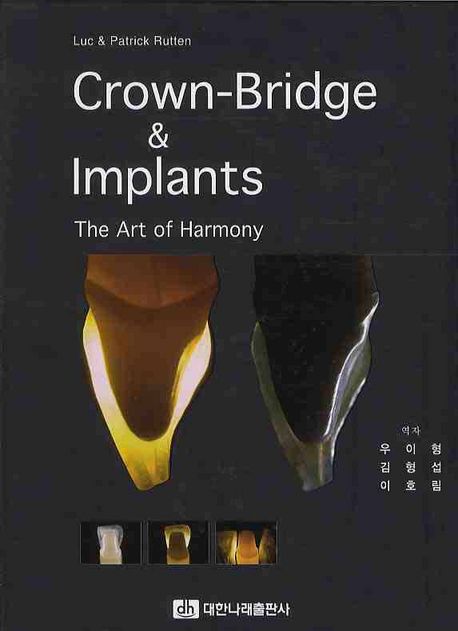 CROWN-BRIDGE AND IMPLANTS | LUC RUTTEN - 교보문고