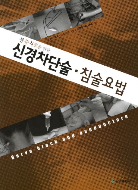 신경차단술 침술요법 - 교보문고