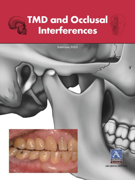 TMD and Occlusal Interferences | 이수빈 - 교보문고