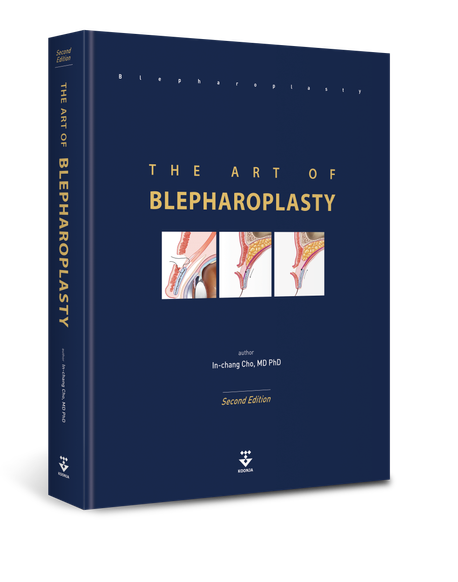 裁断済❗️韓国の眼瞼手術の名著❗️The Art of Blepharoplasty THE ART OF BLEPHAROPLASTY | InChang Cho - 교보문고