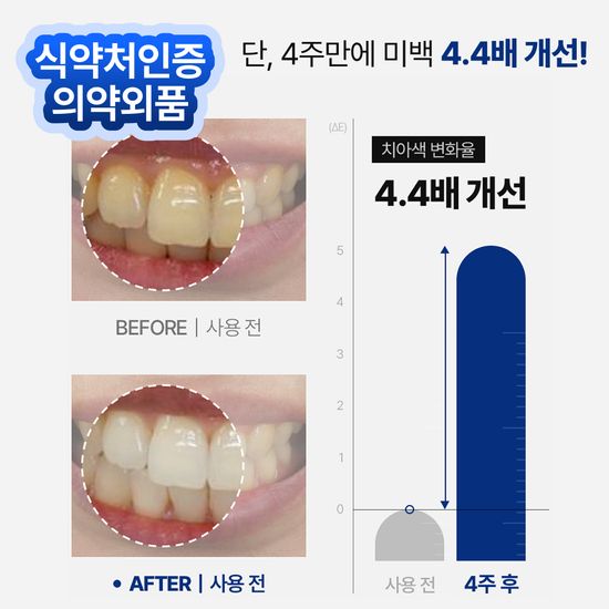 [약국] 미백임상인증 치과 치아미백제 스마일밤
