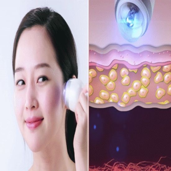 쁘띠셀 간접고주파기 두피마사지 피부마사지