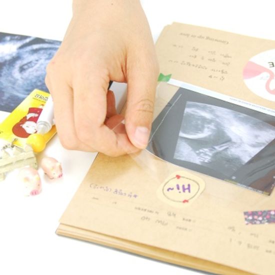 A5초음파앨범 리필내지-초음파사진노트 set