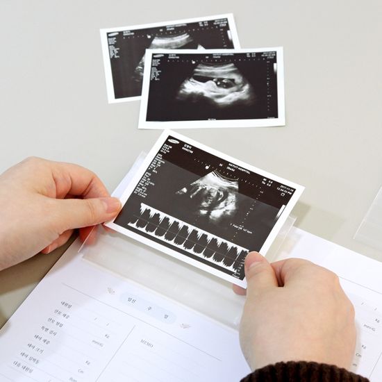 처음부모 임신 다이어리