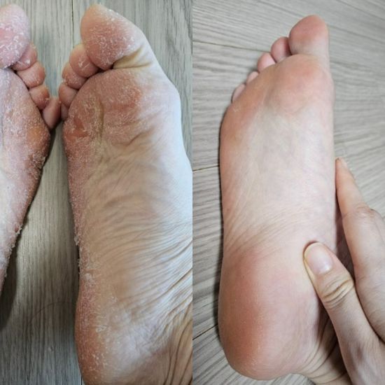 페로린 뒤꿈치갈라짐 각질제거 풋필링팩 로즈향 2회분