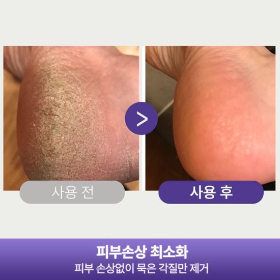 [풀리오] 패디플래너/발각질제거기 프리미엄 8종세트