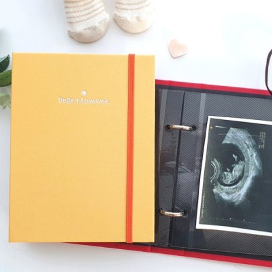 쁘띠 임신 초음파앨범 A6 바인더-옐로우