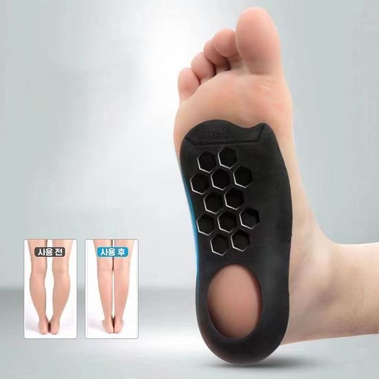 케이맘 아치깔창 자세교정 깔창 기능성 1 세트 J416-O