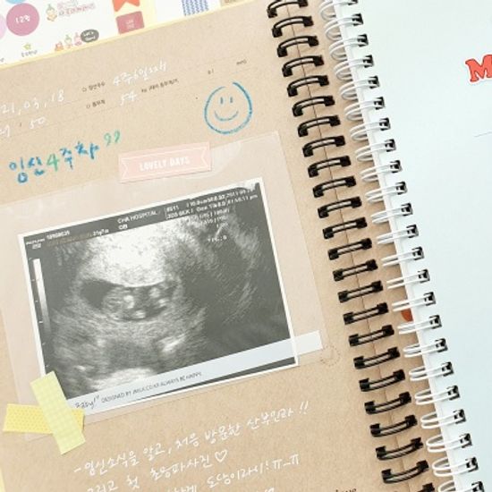 끼리둥이 초음파앨범(임신다이어리)