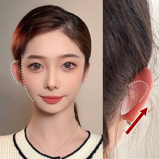 네이리 누운귀테이프 얼굴리프팅 엘프 귀 교정테이프